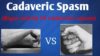 Cadaveric spasm  Difference between Rigor mortis amp Cadaveric spasm [upl. by Debbra821]