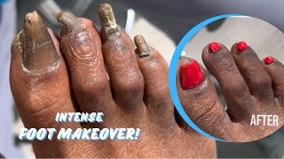 INTENSE FOOT MAKEOVER  PART 2 FINAL RESULT [upl. by Fagen]