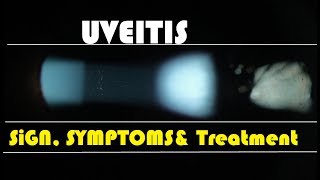 Uveitis Hindi [upl. by Aloin332]