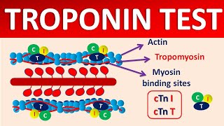 Troponin test and its significance [upl. by Yrod]