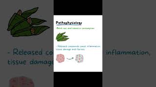 Oral Submucous Fibrosis Osmf Oral Medicine And Oral Pathology [upl. by Irt]