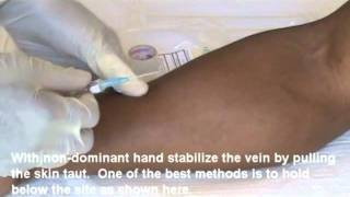 IV Insertion Video Demo 1 of 2mp4 [upl. by Sosanna]