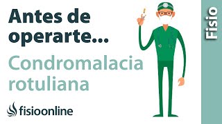 5 Cosas que debes de saber si vas a operarte de CONDROMALACIA ROTULIANA o desgaste de rótula [upl. by Aihsenet]