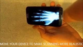 Xray body scanner simulator for ANDROID [upl. by Winfrid]