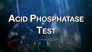 Acid Phosphatase Test [upl. by Odrawde]