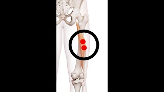 Bicep Femoris Hamstrings Muscle Trigger Points [upl. by Twitt72]