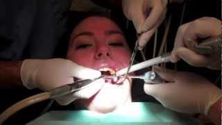 What Is It Like To Get A Filling In Your Tooth With Footage From The Dentists Office [upl. by Naugal]