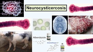 neurocysticercosis [upl. by Nodrog]