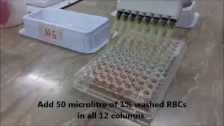 AJs Science 2 How to perform Hemagglutination assay HA Test [upl. by Charmane773]