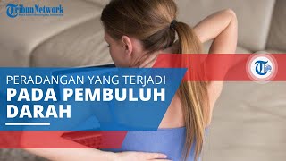 Mengenal Vaskulitis Peradangan Pembuluh Darah yang Menyebabkan Perubahan Dinding Pembuluh [upl. by Artaed]