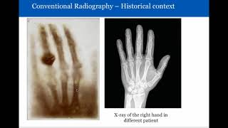 Introduction to Radiology Conventional Radiography [upl. by Ahsym895]