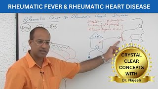 Pathogenesis of Rheumatic Fever  Rheumatic Heart Disease 🧑🏻‍⚕️ [upl. by Elagiba697]