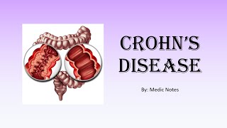 Crohns disease  vs ulcerative colitis extraintestinal manifestation investigation treatment [upl. by Jorey]