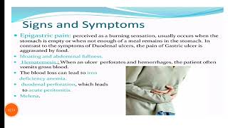 Dental management of epigastric pain by Himani sharma [upl. by Innej]