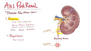 Patofisiologi  Cidera Ginjal Akut Postrenal  Azotemia  Acute Kidney Injury [upl. by Bastian]