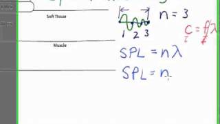 Ultrasound Physics Spatial Pulse Length SPL [upl. by Geraud]