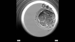 Blastocyst seen with EmbryoScope [upl. by Dewey]