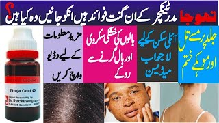 Thuja Q Uses in Urdu  thuja occ 200 benefits thuja q uses [upl. by Addiel]