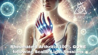 Rheumatoid Arthritis 100 GONE following Scalar Light Sessions [upl. by Redfield]