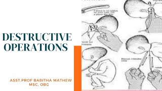 distructive operationcraniotomyevicerationcledotomydecapitationindicationmanagement [upl. by Ardnekal802]