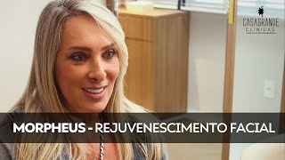 MORPHEUS  Procedimento de rejuvenescimento completo [upl. by Cleopatra]