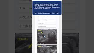 Do you know the answer Ace the boards with Top Score Radiology SpacedRepetition Flashcards [upl. by Manning787]