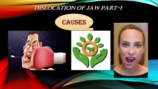 TMJ Dislocation subluxation [upl. by Hyman]