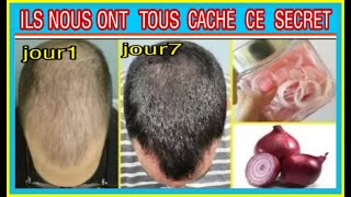 TOUT HOMME DEVRAIS SAVOIR CE SECRET REPOUSSE ACCELERER DE LA CALVITIE ET DENTRETIENT DE CHEVEUX [upl. by Hubey]