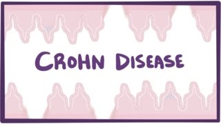 Crohns disease Crohn disease  causes symptoms amp pathology [upl. by Adorne]