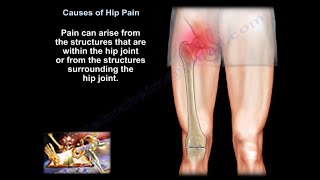 hip pain causes diagnosis and treatment [upl. by Swainson]