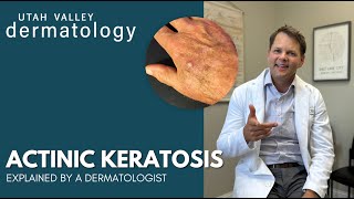 Actinic Keratosis Explained by a Dermatologist  Utah Valley Dermatology [upl. by Wardieu452]