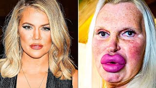 20 Celebrity Plastic Surgery Disasters [upl. by Eeniffar]