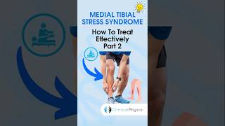 Treating Medial Tibial Stress Syndrome Pt 2 Exercises physicaltherapy physiotherapy shinsplints [upl. by Terb]