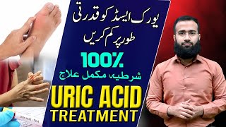 Uric Acid Treatment  Natural Remedies for GOUT Get Rid of Hyperuricemia [upl. by Cyrillus181]