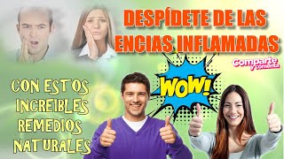 💥ENCIAS INFLAMADAS💥 Remedios CaserosDespídete de las ENCIAS INFLAMADAS Rápido con estos consejos💚 [upl. by Cresida480]