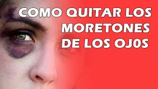 Como Quitar Los Moretones De Los Ojos [upl. by Eeleak]