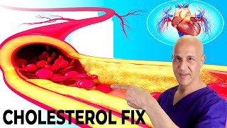 The Most Effective Way to Lower Your Cholesterol Naturally in 7 Days Dr Mandell [upl. by Ahsele]