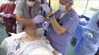 Severe Arthritic Syndrome Awake Intubation from AOD [upl. by Xeno]