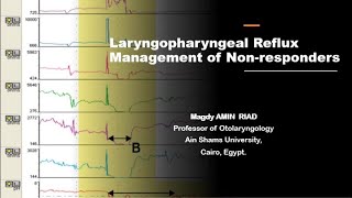 Laryngopharyngeal Reflux Management of Non responders [upl. by Maxey]