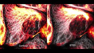 Comparison of confocal and STED timelapse movies of Vimentin and tubulin dynamics [upl. by Alicea]