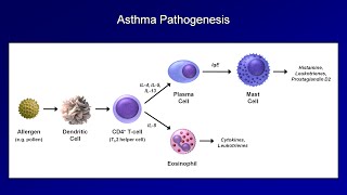 Asthma and COPD  Pathogenesis and Pathophysiology [upl. by Hoopes]