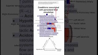 Conditions associated with persistent fetal circulation [upl. by Airotnahs]