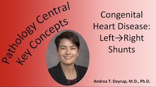 Medical School Pathology Pathophysiology of Congenital Heart Disease Left to Right Shunts [upl. by Waechter]