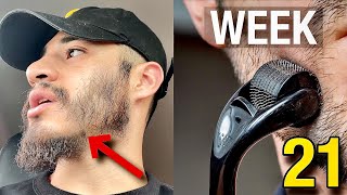 DERMAROLLER FAQ  Week 21 Minoxidil Beard Growth Journey WEEKLY UPDATE [upl. by Hartzke]