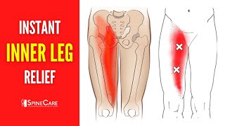 How to Fix Inner Leg Pain FOR GOOD [upl. by Thorne]