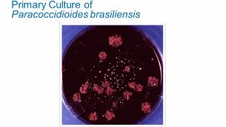 Dimorphic Fungi Paracoccidioidomycosis and Penicilliosis Hot Topic [upl. by Romain]