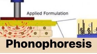 PHONOPHORESIS [upl. by Goodyear]