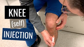 Knee Injection Steroid Technique Blind Anterolateral Approach [upl. by Ahsille]