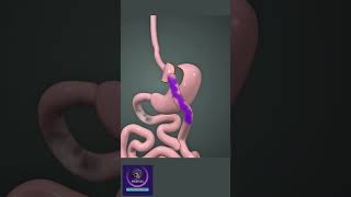 Gastric bypass surgery  weight loss surgical procedure [upl. by Marcin]