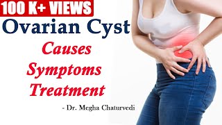 Ovarian Cyst Causes Symptoms and Treatment [upl. by Aynekal]